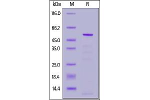 Coronavirus OC43 Nucleoprotein (HCoV-OC43 N) (AA 1-448) protein (His tag)