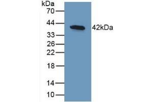 Detection of Recombinant BMP10, Human using Monoclonal Antibody to Bone Morphogenetic Protein 10 (BMP10) (BMP10 Antikörper  (AA 315-424))