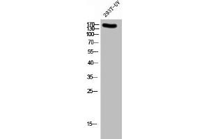 Western Blot analysis of 293T-UV cells using Phospho-NMDAε2 (Y1336) Polyclonal Antibody (GRIN2B Antikörper  (pTyr1336))