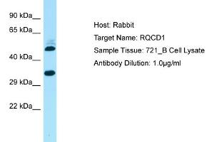 Host: Rabbit Target Name: RQCD1 Sample Type: 721_B Whole Cell lysates Antibody Dilution: 1. (RQCD1 Antikörper  (Middle Region))