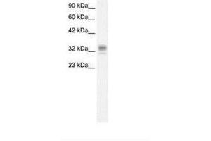 Image no. 1 for anti-Asialoglycoprotein Receptor 1 (ASGR1) (AA 100-149) antibody (ABIN6736268) (Asialoglycoprotein Receptor 1 Antikörper  (AA 100-149))