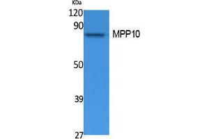 Western Blotting (WB) image for anti-M-Phase phosphoprotein 10 (U3 Small Nucleolar Ribonucleoprotein) (MPHOSPH10) (Internal Region) antibody (ABIN3178110) (MPHOSPH10 Antikörper  (Internal Region))