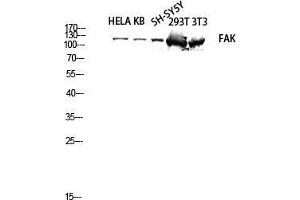 Western Blot (WB) analysis of HeLa KB SH-SY5Y 293T 3T3 lysis using FAK antibody. (FAK Antikörper  (Thr402, Thr421, Thr423))