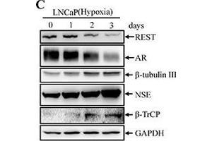 Hypoxia induces NED of LNCaP cells concomitant with down-regulation REST protein levels but not REST mRNA(A) LNCaP cells were treated with hypoxia (2 % O2) for 3 days. (BTRC Antikörper)