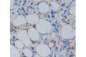 Immunohistochemistry (IHC) image for anti-Myosin, Heavy Chain 7B, Cardiac Muscle, beta (MYH7B) (AA 829-1106) antibody (ABIN1869362)