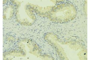 ABIN6272461 at 1/100 staining Mouse colon tissue by IHC-P. (WASF1 Antikörper  (Internal Region))