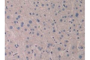 Detection of 5-LO in Human Liver Tissue using Polyclonal Antibody to 5-Lipoxygenase (5-LO)