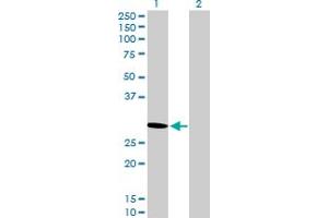 Western Blotting (WB) image for anti-Proteasome (Prosome, Macropain) Activator Subunit 2 (PA28 Beta) (PSME2) (AA 1-239) antibody (ABIN519418)