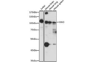 Western blot analysis of extracts of various cell lines, using VAV3 antibody. (VAV3 Antikörper)