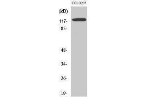 Western Blotting (WB) image for anti-Leptin Receptor (LEPR) (Internal Region) antibody (ABIN3185989) (Leptin Receptor Antikörper  (Internal Region))