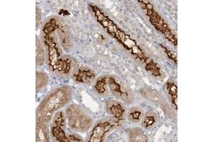 Immunohistochemical staining of human kidney with ATP11A polyclonal antibody  shows strong membranous and cytoplasmic positivity in cells in tubules. (ATP11A Antikörper)
