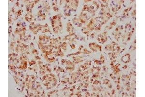 Immunohistochemistry (IHC) image for anti-CDC5 Cell Division Cycle 5-Like (S. Pombe) (CDC5L) antibody (ABIN7127416)