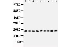 Anti-Ribonuclease A antibody, Western blotting All lanes: Anti Ribonuclease A  at 0. (RNASE1 Antikörper  (Middle Region))