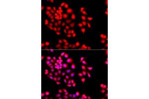 Immunofluorescence analysis of A549 cells using STXBP2 antibody. (STXBP2 Antikörper)