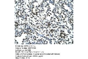 Human Lung (SIRT5 Antikörper  (Middle Region))