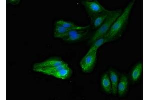 Immunofluorescent analysis of HepG2 cells using ABIN7166940 at dilution of 1:100 and Alexa Fluor 488-congugated AffiniPure Goat Anti-Rabbit IgG(H+L) (MYRIP Antikörper  (AA 387-689))