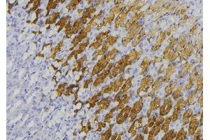 ABIN6278469 at 1/100 staining Human gastric tissue by IHC-P. (GUCY1B2 Antikörper)
