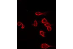 ABIN6266530 staining Hela by IF/ICC. (Dysferlin Antikörper  (C-Term))