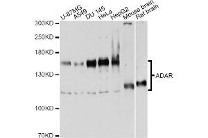 Western blot analysis of extracts of various cell lines, using ADAR antibody. (ADAR Antikörper)