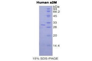 SDS-PAGE (SDS) image for alpha-2-Macroglobulin (A2M) (AA 616-856) protein (His tag) (ABIN2120515)