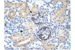 CLIC5 antibody was used for immunohistochemistry at a concentration of 4-8 ug/ml to stain Epithelial cells of renal tubule (arrows) in Human Kidney. (CLIC5 Antikörper  (C-Term))