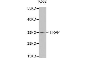 Western Blotting (WB) image for anti-Toll-Interleukin 1 Receptor (TIR) Domain Containing Adaptor Protein (TIRAP) antibody (ABIN1875100) (TIRAP Antikörper)