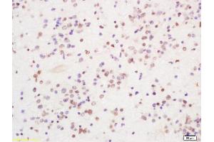 Immunohistochemistry (IHC) image for anti-Ring Finger and CHY Zinc Finger Domain Containing 1, E3 Ubiquitin Protein Ligase (RCHY1) (AA 31-130) antibody (ABIN1386185)