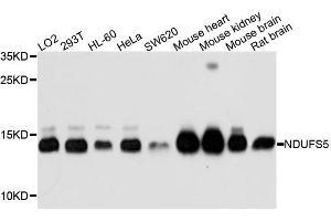 Western blot analysis of extracts of mouse liver tissue lines, using NDUFS5 antibody.