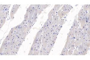 Detection of SEMA3A in Human Heart Tissue using Monoclonal Antibody to Semaphorin 3A (SEMA3A) (SEMA3A Antikörper  (AA 580-664))