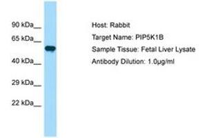 Image no. 1 for anti-Phosphatidylinositol-4-Phosphate 5-Kinase, Type I, beta (PIP5K1B) (AA 395-444) antibody (ABIN6750033) (PIP5K1B Antikörper  (AA 395-444))