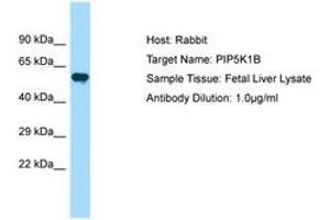 Image no. 1 for anti-Phosphatidylinositol-4-Phosphate 5-Kinase, Type I, beta (PIP5K1B) (AA 395-444) antibody (ABIN6750033)