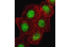Fluorescent image of A549 cell stained with CREB1 Antibody . (CREB1 Antikörper  (AA 105-132))