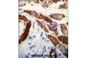 FLNA Antibody (Y1046) immunohistochemistry analysis in formalin fixed and paraffin embedded human skeletal muscle followed by peroxidase conjugation of the secondary antibody and DAB staining. (Filamin A Antikörper  (AA 1025-1054))