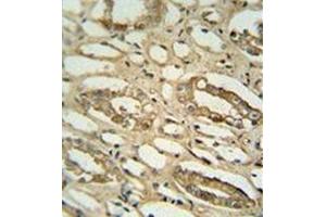 Immunohistochemistry analysis in formalin fixed and paraffin embedded human lung tissue reacted with GGTLC2 Antibody (Center) followed peroxidase conjugated to the secondary antibody and followed by DAB staining.