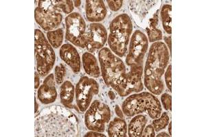 Immunohistochemical staining of human kidney with CPSF3L polyclonal antibody  shows strong cytoplasmic positivity in cells in tubules. (CPSF3L Antikörper)