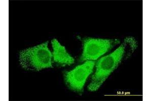 Immunofluorescence of monoclonal antibody to SCYE1 on HeLa cell. (AIMP1 Antikörper  (AA 1-312))