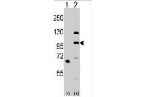 Western blot analysis of MLK4 (arrow) using rabbit MLK4 polyclonal antibody .