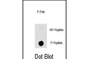 Dot blot analysis of anti-K1-p Phospho-specific b (ABIN389799 and ABIN2839695) on nitrocellulose membrane. (MAP3K8 Antikörper  (pThr290))