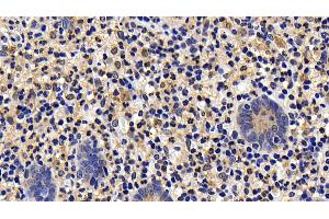 Immunohistochemistry (IHC) image for anti-BH3 Interacting Domain Death Agonist (BID) (AA 1-195) antibody (ABIN7432259)