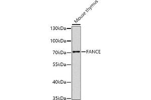 Western blot analysis of extracts of mouse thymus, using FANCE antibody (ABIN6129378, ABIN6140472, ABIN6140473 and ABIN6224472) at 1:1000 dilution.