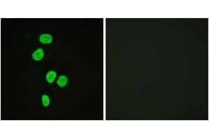 Immunofluorescence analysis of HeLa cells, using AS160 (Ab-642) Antibody. (TBC1D4 Antikörper  (AA 611-660))
