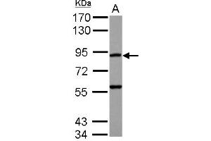 Western Blotting (WB) image for anti-RAS P21 Protein Activator 4 (RASA4) (N-Term) antibody (ABIN1494072)