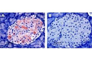 Expression of Kir6. (Potassium Inwardly-Rectifying Channel, Subfamily J, Member 11 (KCNJ11) Peptid)