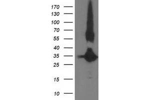 Western Blotting (WB) image for anti-Monoglyceride Lipase (MGLL) antibody (ABIN1499437)