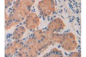 Immunohistochemistry (IHC) image for anti-Immunoglobulin Superfamily Containing Leucine Rich Repeat Protein (ISLR) (AA 19-428) antibody (ABIN7441502)