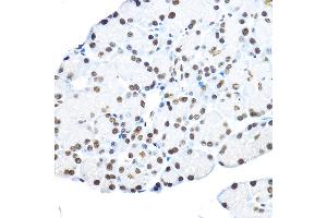Immunohistochemistry of paraffin-embedded rat pancreas using NR5 Rabbit pAb (ABIN6133574, ABIN6144832, ABIN6144834 and ABIN6217774) at dilution of 1:100 (40x lens). (NR5A2 + LRH1 Antikörper  (AA 1-140))