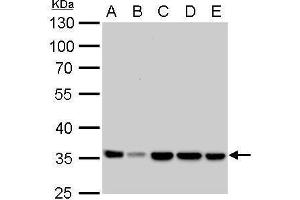WB Image LDHA antibody detects LDHA protein by Western blot analysis. (Lactate Dehydrogenase A Antikörper)