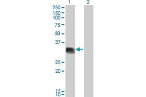 Western Blot analysis of SCML1 expression in transfected 293T cell line by SCML1 monoclonal antibody (M01), clone 4G3. (SCML1 Antikörper  (AA 3-100))