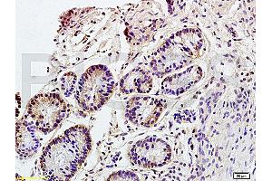Formalin-fixed and paraffin embedded rat colitis tissue labeled with Anti CD98 Polyclonal Antibody, Unconjugated (ABIN719546) at 1:200 followed by conjugation to the secondary antibody and DAB staining (SLC3A2 Antikörper  (AA 231-280))