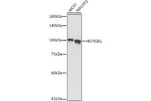 Western blot analysis of extracts of various cell lines, using HSP90B1 antibody (ABIN6130434, ABIN6142031, ABIN6142033 and ABIN7101795) at 1:1000 dilution. (GRP94 Antikörper  (AA 550-650))
